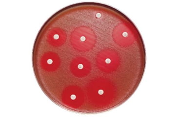 Image of BD Antibiotics and AntimycoticsNorfloxacin to Vancomycin, BD Diagnostics 231601 Trimethoprim, 5 ug